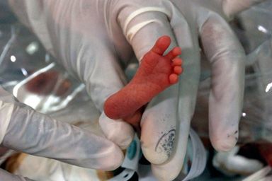Above: A nurse holds the foot of Milagros Pimentel, a baby girl born at 20 weeks in a Colombia hospital.