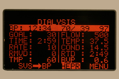 A digital readout is displayed as a patient undergoes dialysis