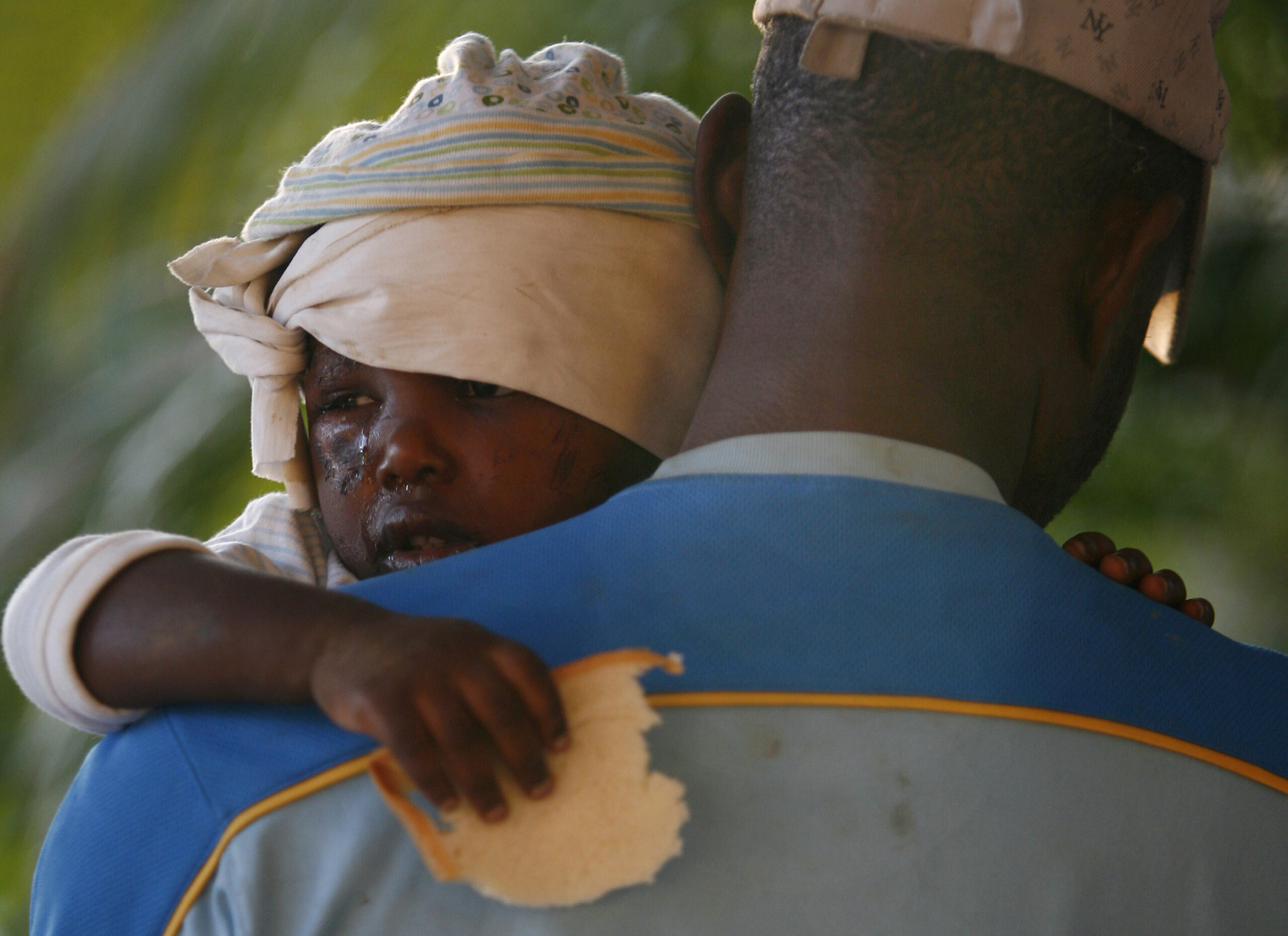 A young injured earthquake survivor holds a piece of bread in a makeshift shelter in Port-au-Prince, Haiti, Thursday, Jan. 14, 2010.  A 7.0-magnitude earthquake struck Haiti Tuesday. (AP Photo/Ricardo Arduengo) (Associated Press)