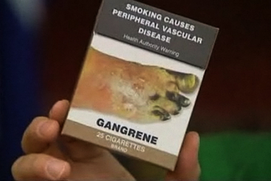 A package of cigarettes in Australia contain a graphic anti-smoking warning.
