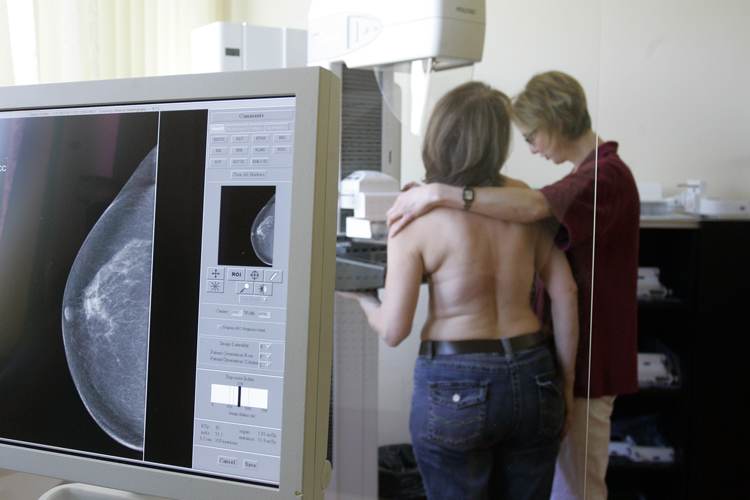 ARCHIV - Eine Roentgenassistentin, rechts, und eine Medizinisch-Technische Assistentin, links, demonstrieren am 26. April 2007 das Mammographie Screening Programm in Berlin. Ein Streit um die beste Brustkrebs-Frueherkennung bei Frauen mit erhoehtem Erkrankungsrisiko entzweit deutsche Mediziner. Hintergrund ist eine Studie, der zufolge die Magnetresonanztomografie (MRT) bei diesen Frauen Tumore weit zuverlaessiger aufspuert als die gaengige Mammografie. (AP Photo/Franka Bruns) ** zu unserem KORR APD6735 ** --- FILE - X-ray technician Martina Rosenow, right, and assistant medical technician Marianne Warnholz, left, demonstrate the mammogram screening program in Berlin, Thursday, April 16, 2007. The nation-wide program for the early diagnosis of breast cancer is available in Berlin. (AP Photo/Franka Bruns)  ** PLS NOTE NUDITY**- (Franka Bruns)