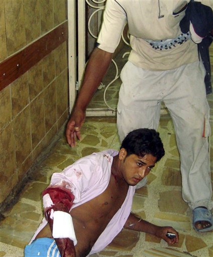 A victim of a suicide attack waits for a doctor on the floor of the emergency room of a hospital in Baghdad, Iraq, Tuesday, Aug. 17, 2010. A suicide bomber blew himself up Tuesday among hundreds of army recruits who had gathered near a military headquarters in central Baghdad killing and wounding dozens of them. (AP Photo) (AP)