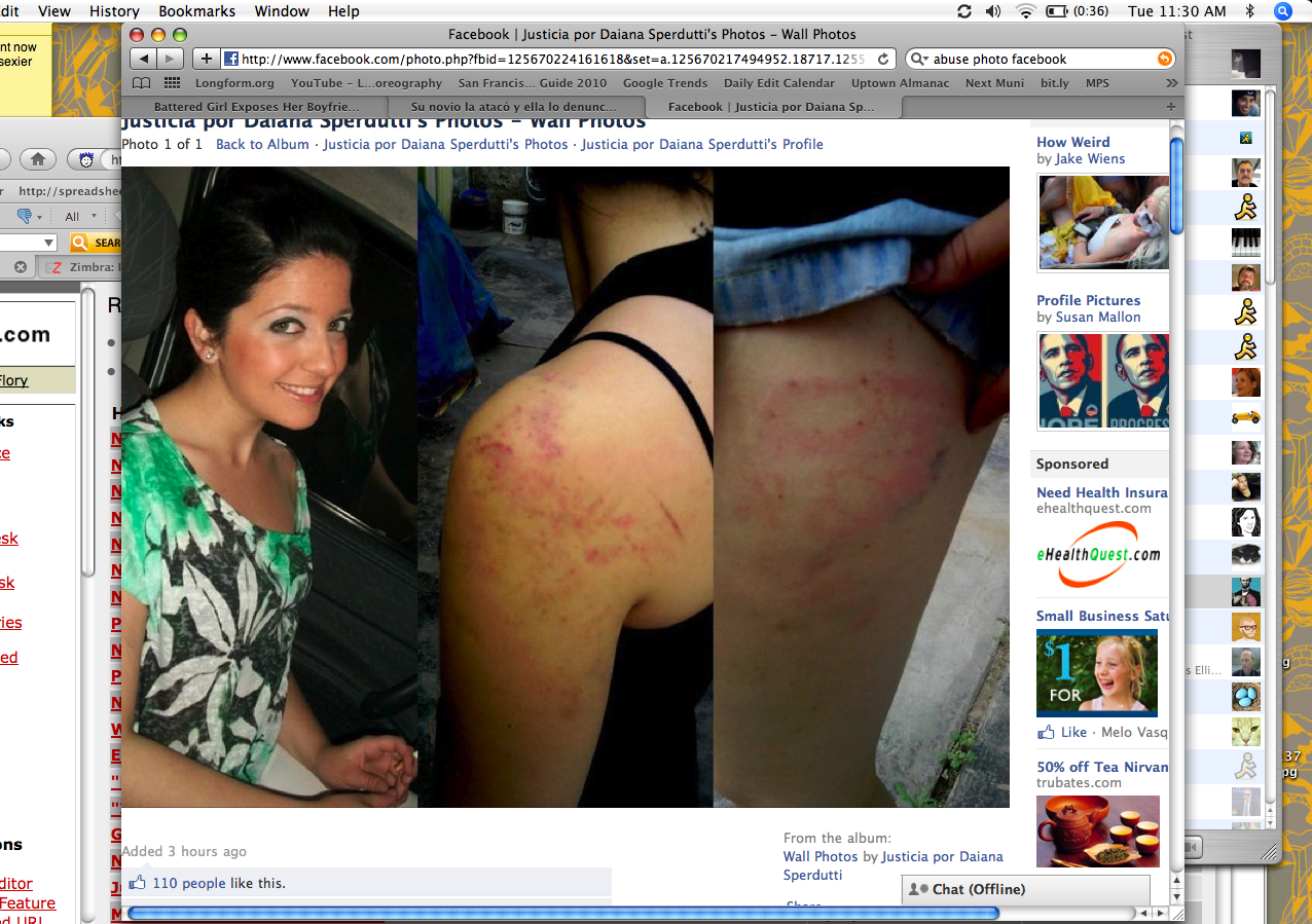 Photos of Daiana Sperdutti and her injuries from a Facebook fan page