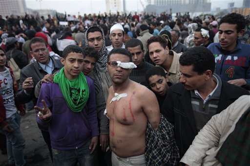 An Egyptian anti-government activist, wounded during clashes with police, poses for the photographer along with other protesters in Tahrir square in Cairo, Egypt, early Saturday, Jan. 29, 2011. Mobile phone service have been partially restored in Egypt, Saturday, after the recent communications blackout. (AP Photo/Lefteris Pitarakis) (AP)
