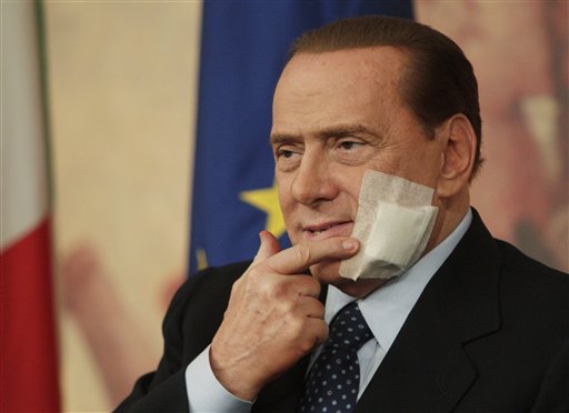 Italian Premier Silvio Berlusconi touches his face during a press conference following a cabinet meeting on the justice reforms, in Rome, Thursday, March 10, 2011. Berlusconi has an adhesive bandage on his face after undergoing jaw surgery earlier this week. (AP Photo/Andrew Medichini) (AP)