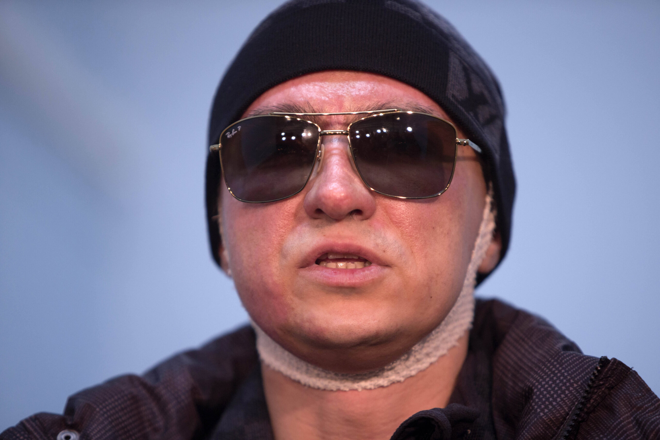 Sergei Filin speaks with the media as he leaves a hospital in Moscow, Russia. (AP/Misha Japaridze)