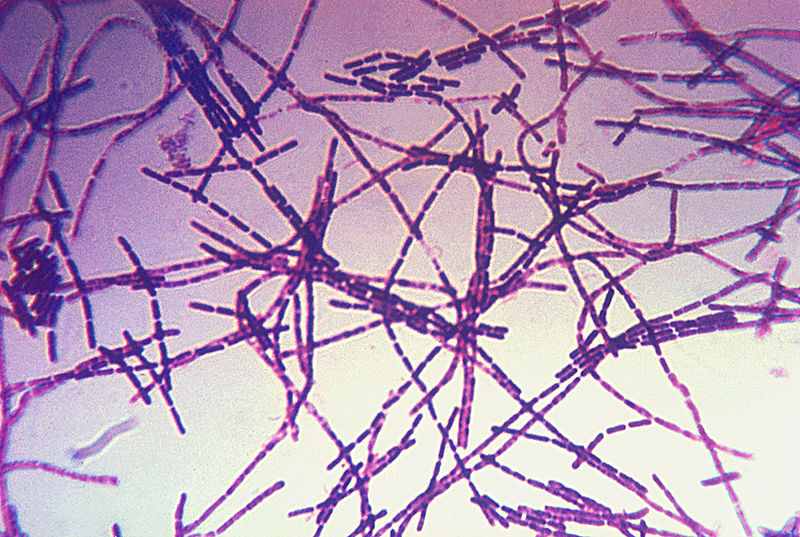 Anthrax (Wikimedia/CDC)