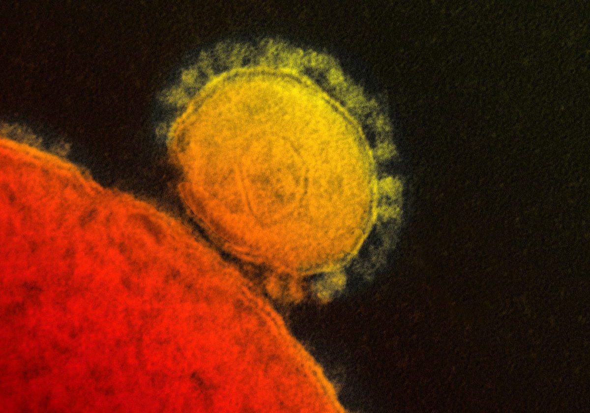 FILE - This file photo provided by the National Institute for Allergy and Infectious Diseases shows a colorized transmission of the MERS coronavirus that emerged in 2012. ((AP Photo/National Institute for Allergy and Infectious Diseases via The Canadian Press, File))