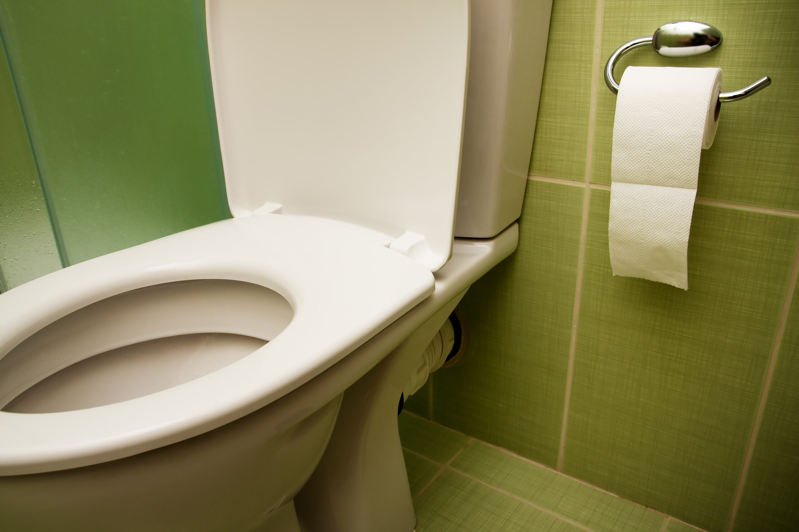 Toilet seat (Shutterstock/Dundanim)