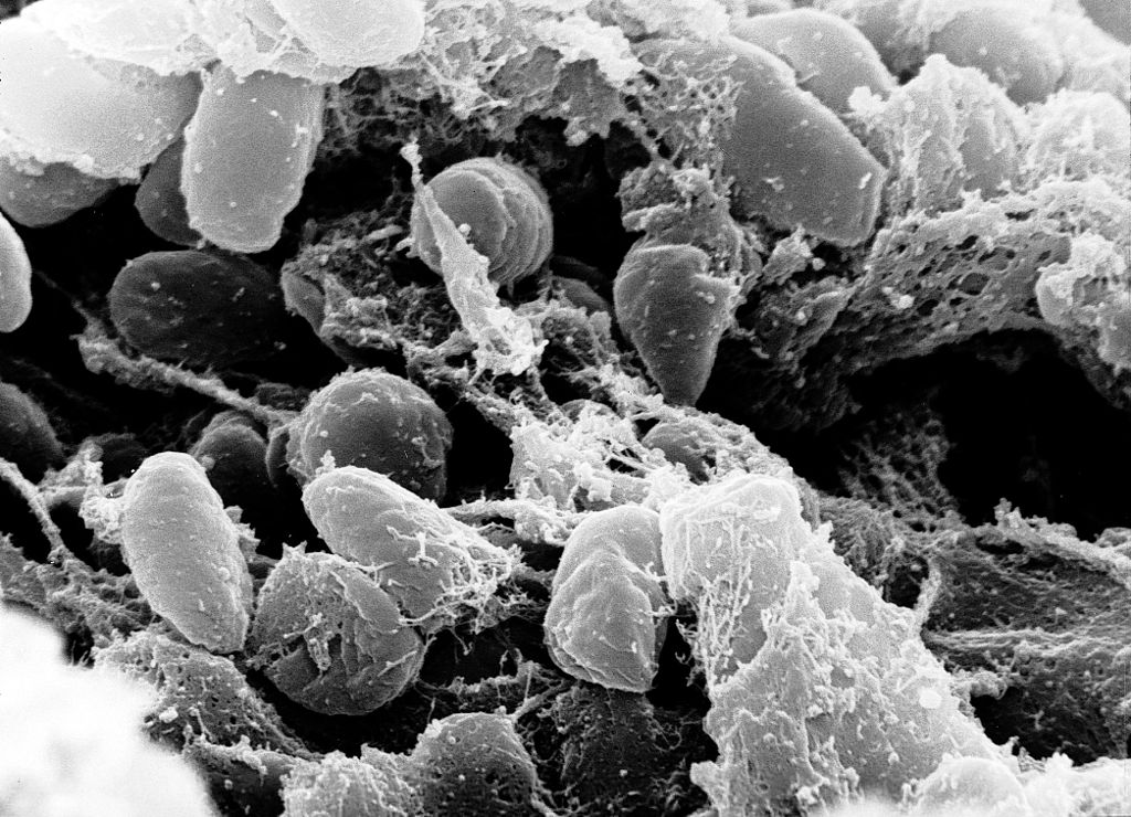 Scanning electron micrograph depicting a mass of Yersinia pestis bacteria (the cause of bubonic plague) in the foregut of the flea vector (NIH/Wikimedia Commons)