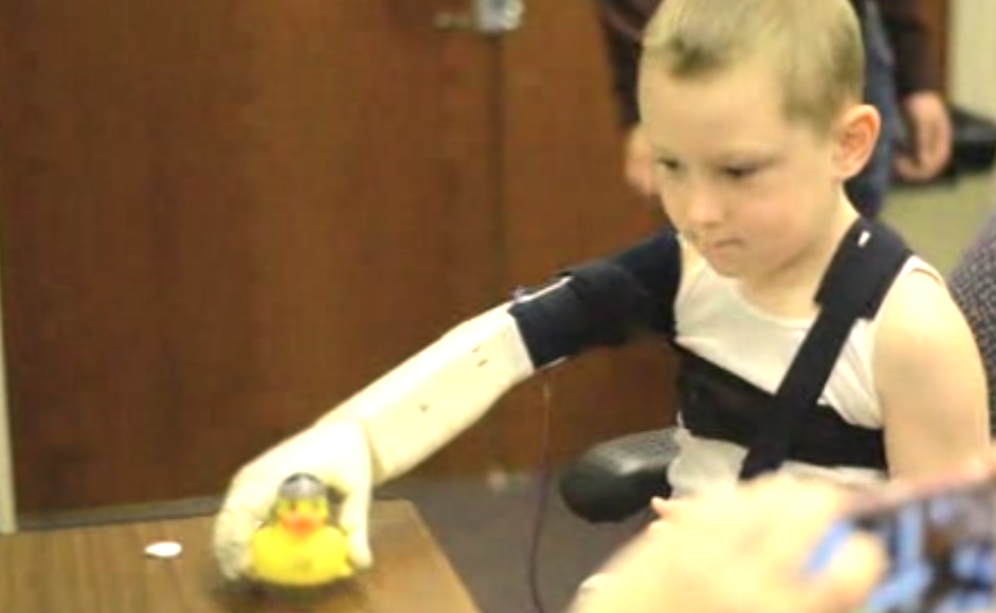 Alex Pring's bionic arm (screenshot)