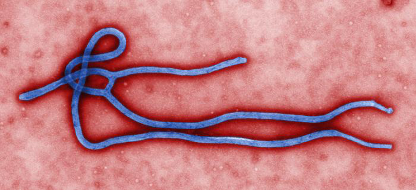 FILE - This undated file image made available by the CDC shows the Ebola Virus. As a deadly Ebola outbreak continues in West Africa, health officials are working to calm fears that the virus easily spreads, while encouraging those with symptoms to get medical care. (AP Photo/CDC, File) (AP)