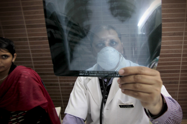 A doctor examines a X-ray of a tuberculosis patient in Jammu, India. (AP/Channi Anand)