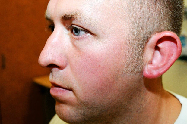 St. Louis County Prosecutor's Office photo shows Darren Wilson photo taken shortly after August 9, 2014 shooting of Michael Brown. (Reuters)