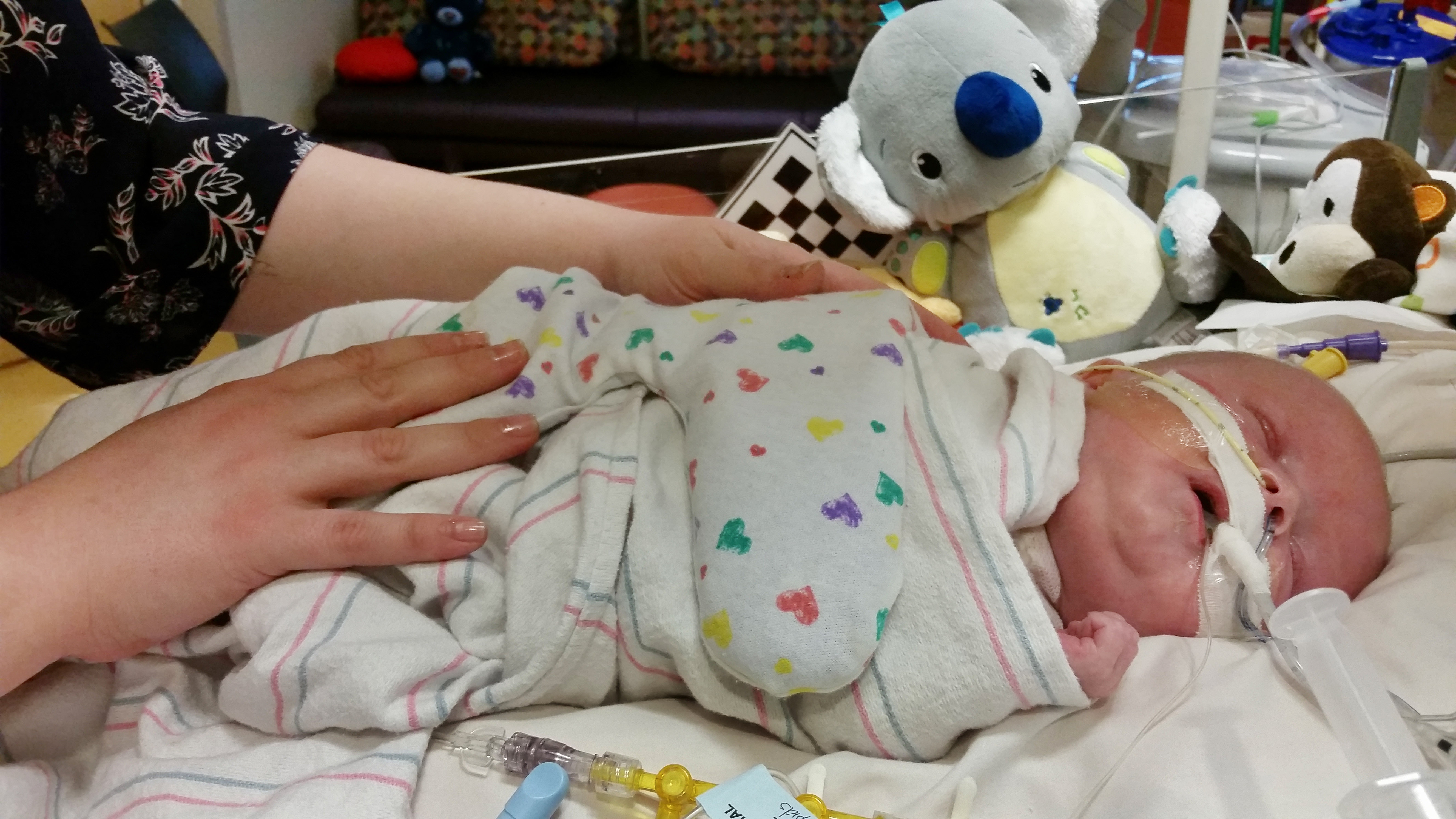 Caylyn Otto places her hands on her son, Oliver, at the Phoenix Children's Hospital in Phoenix on Friday, Feb. 13, 2015. Born nearly seven weeks early, the baby is one of the youngest heart transplant recipients at Phoenix Children's Hospital. Doctors say Oliver, who was due Feb. 20, has been doing remarkably well post-transplant. (AP Photo/Terry Tang) (AP)