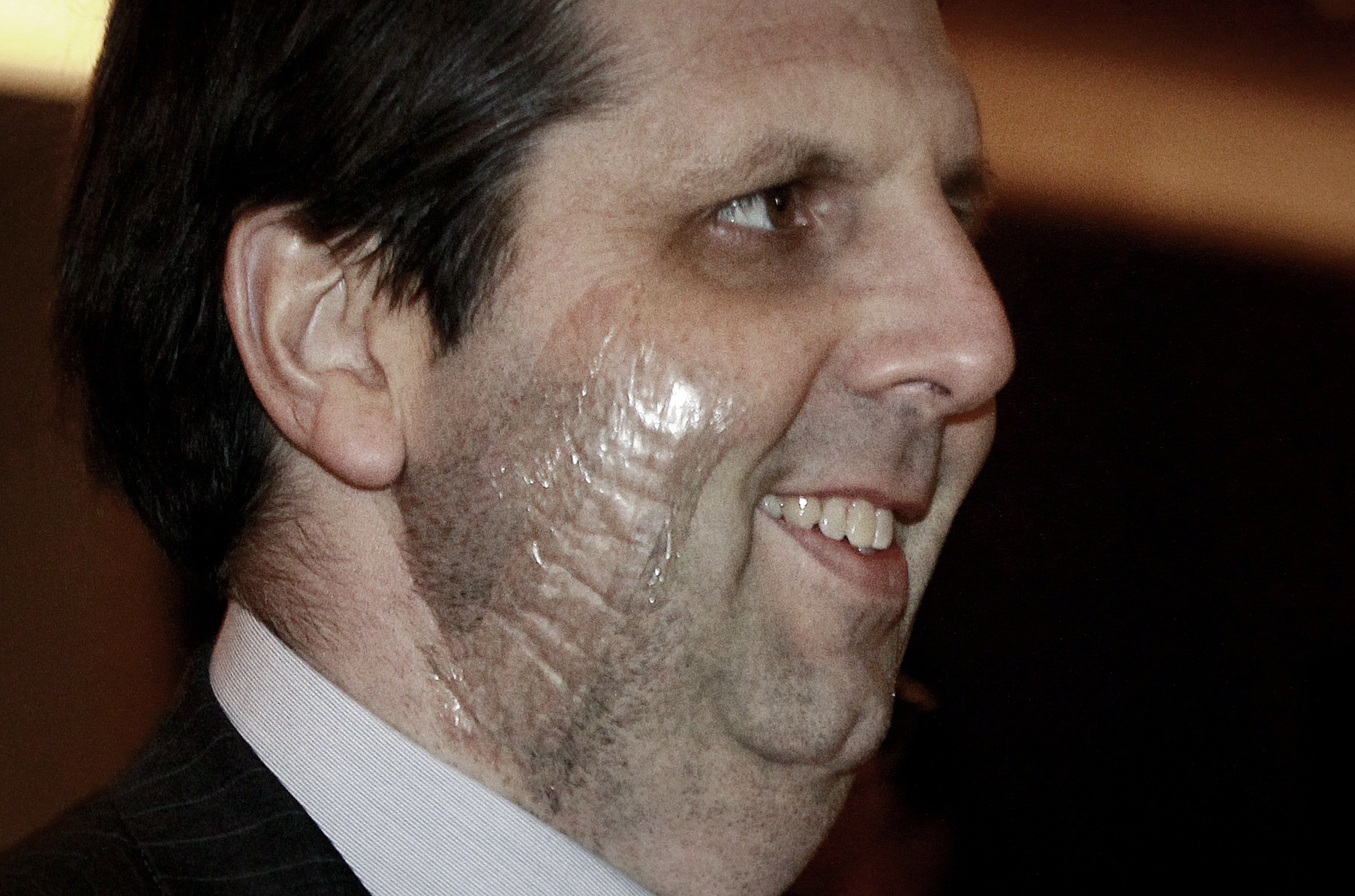 Ambassador to South Korea Mark Lippert smiles as he arrives to attend a dinner for the United States Forces Korea at Chosun Hotel in Seoul, South Korea, Friday, March 13, 2015. South Korean police said Friday that the anti-U.S. arrested last week for allegedly stabbing Lippert had intended to kill the envoy to highlight his protest against ongoing U.S.-South Korean military drills.(Ahn Young-joon) (Ahn Young-joon)