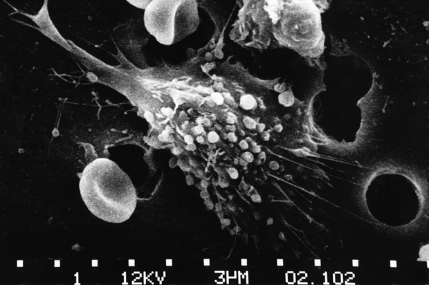 (Wikimedia/National Cancer Institute)