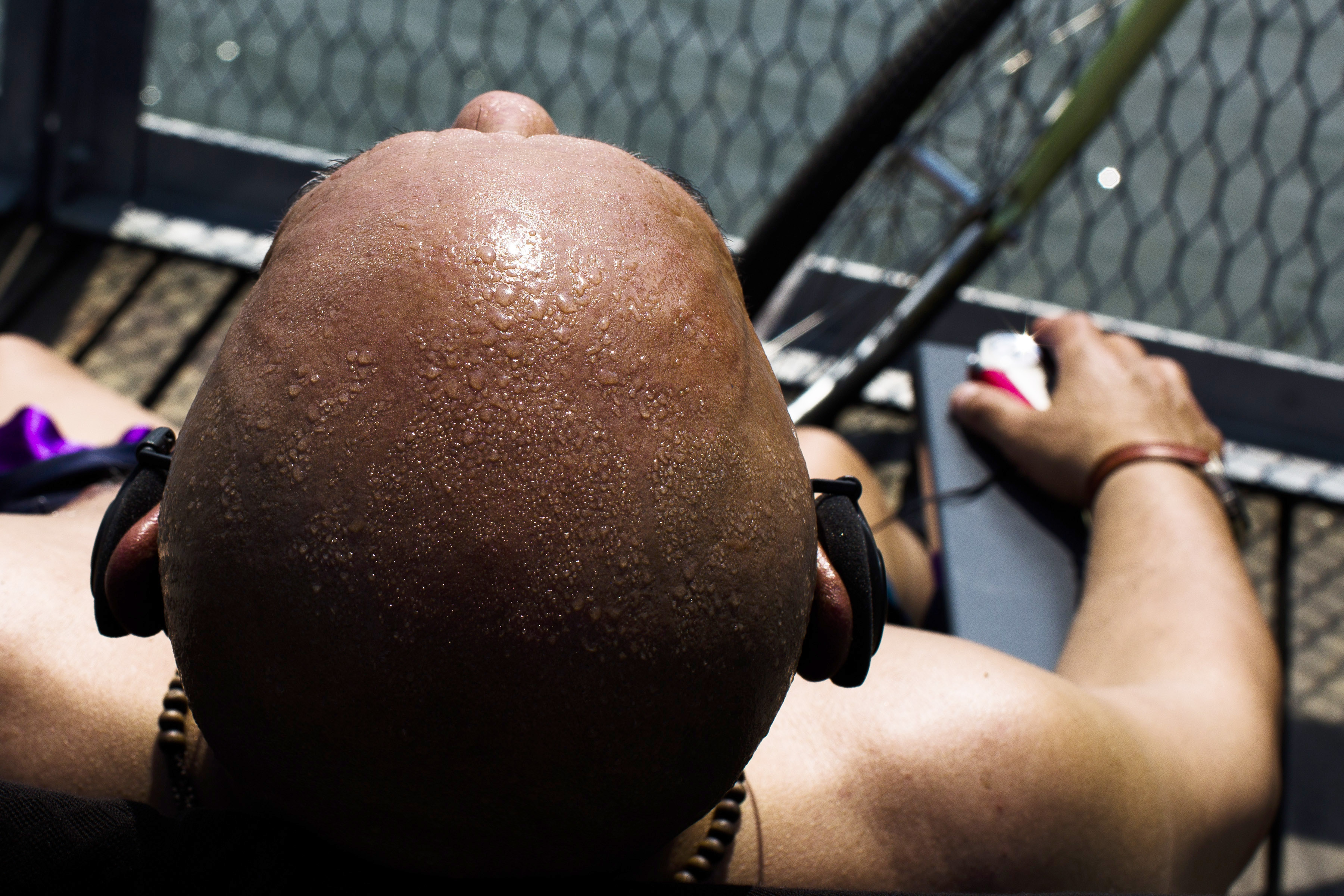 FILE - In this Tuesday, May 21, 2013 file photo, beads of sweat appear on the head of a sunbather near South Street Seaport in New York. A large study released Wednesday, May 13, 2015 suggests that a specific type of vitamin B3 might modestly lower the risk of the most common types of skin cancer in people with a history of these relatively harmless yet troublesome growths. In a study in Australia, people who took nicotinamide for a year had a 23 percent lower rate of new skin cancers compared to others who took dummy pills. The study did not involve melanoma, the most deadly form of skin cancer. (AP Photo/John Minchillo) (AP)
