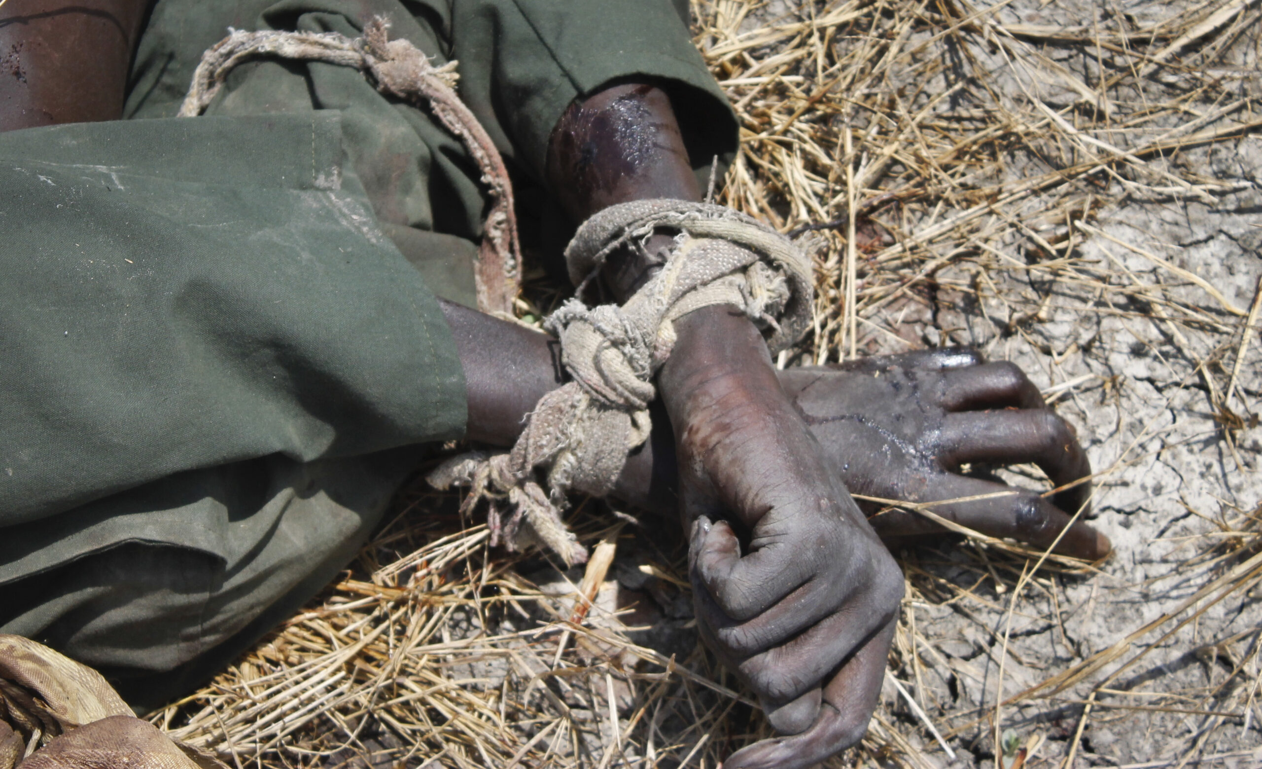 In this photo taken Sunday, Oct. 16, 2016, the body of a rebel soldier who died in a battle days before is seen with his hands tied, in Malakal, South Sudan. Following clashes last week in the outskirts of the city, which has been reduced to rubble and almost entirely deserted by civilians, the army flew in journalists on Sunday to show that they retain control of the strategic city, even though rebels still vow to take it. (AP Photo/Justin Lynch) (AP)
