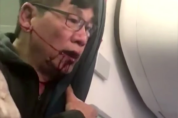 David Dao (YouTube/Inside Edition)