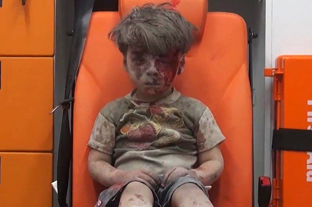 Omran Daqneesh (AP/Aleppo Media Center)
