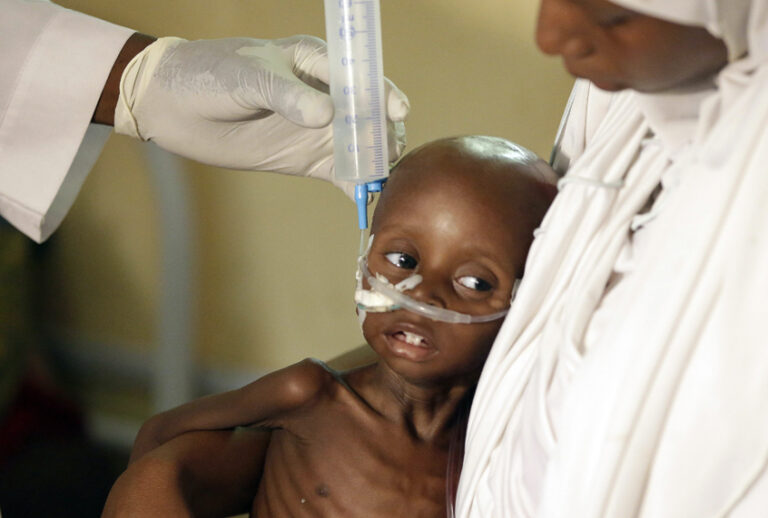 A doctor feeds a malnourished child at a feeding centre run by Doctors Without Borders in Maiduguri, Nigeria. (AP/Sunday Alamba)