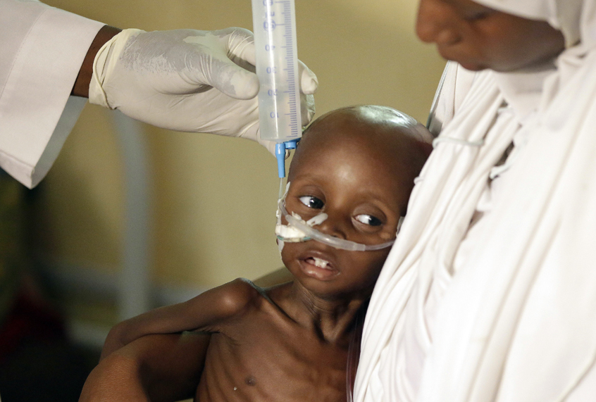 A doctor feeds a malnourished child at a feeding centre run by Doctors Without Borders in Maiduguri, Nigeria. (AP/Sunday Alamba)