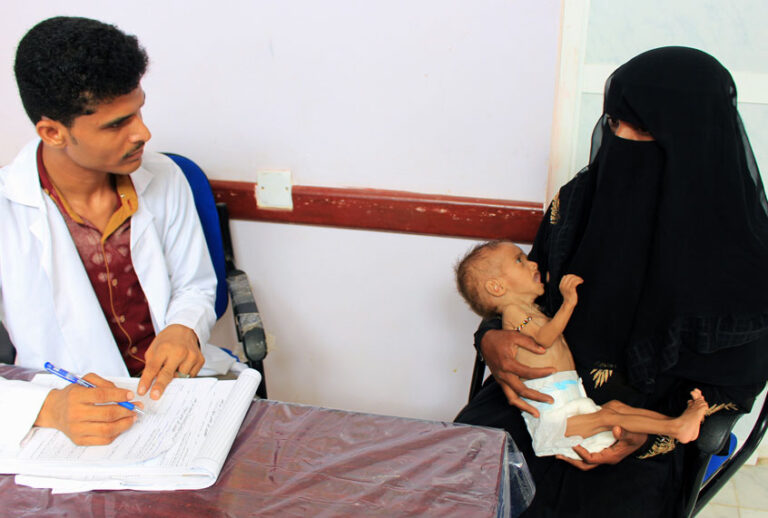 A Yemeni woman holds her child who is suffering from severe malnutrition at a hospital in the northern district of Abs in Yemen's northwestern Hajjah province on November 11, 2018. (Getty/Essa Ahmed)