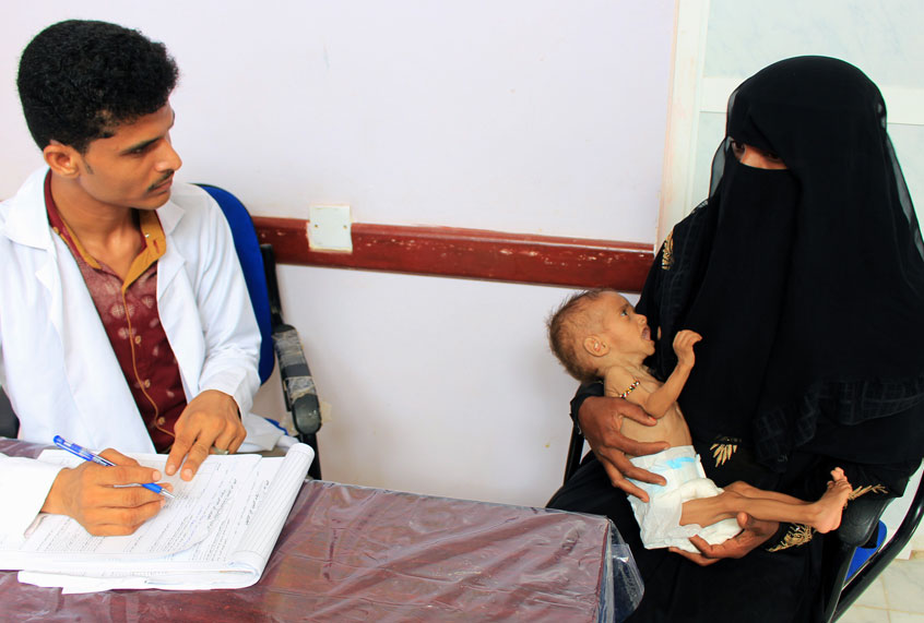 A Yemeni woman holds her child who is suffering from severe malnutrition at a hospital in the northern district of Abs in Yemen's northwestern Hajjah province on November 11, 2018. (Getty/Essa Ahmed)