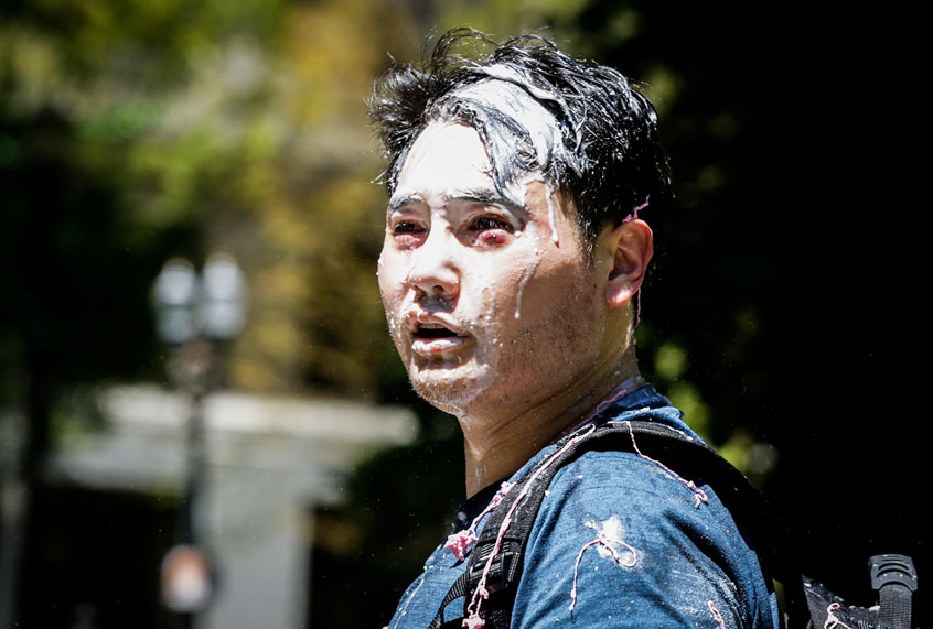 Andy Ngo (Getty/Moriah Ratner/Stringer)