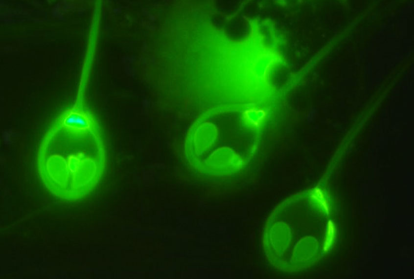 Microscopic spores of the parasite Henneguya salminicola (Stephen Douglas Atkinson)