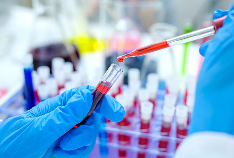 Scientist hand holding test tube with blood in laboratory. (Getty Images)