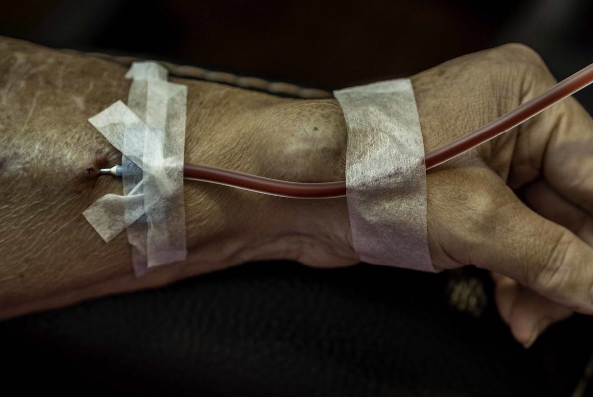 Jo Karabasz says she’s handled a lot in her 58 years of life, but when it comes to her dialysis, she needs things to go smoothly. “Just don’t fuss with me,” she said. (Larry C. Price)