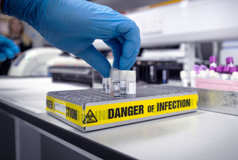 Clinical support technician Douglas Condie extracts viruses from swab samples so that the genetic structure of a virus can be analysed and identified in the coronavirus testing laboratory at Glasgow Royal Infirmary, on February 19, 2020 in Glasgow, Scotland. (Jane Barlow - WPA Pool/Getty Images)