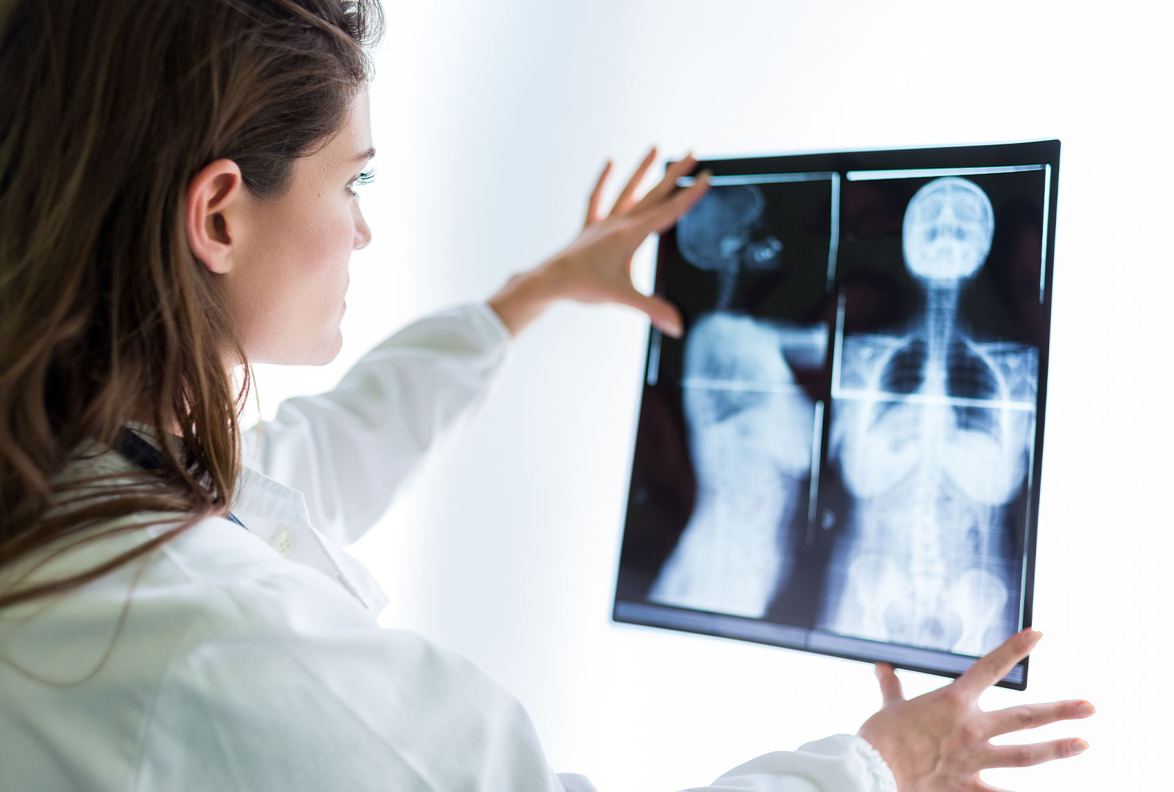 Doctor examining scan (Getty Images)