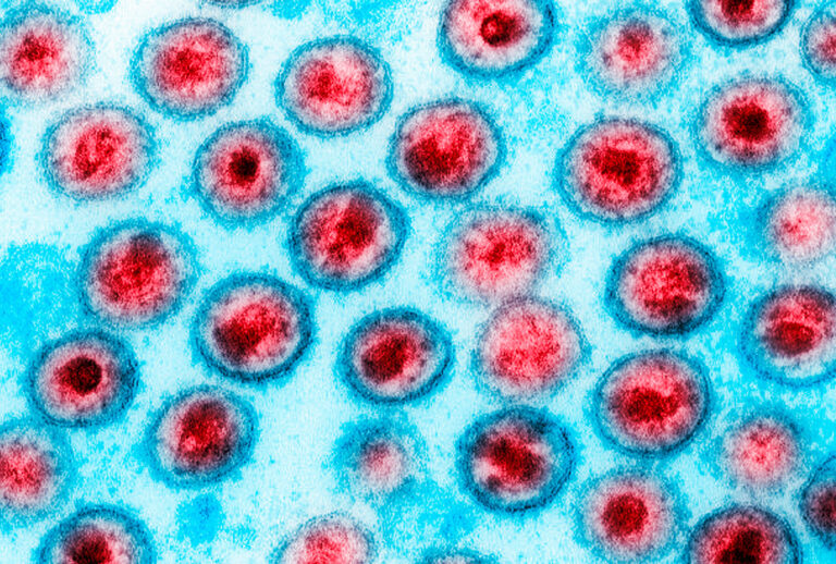 Transmission electron micrograph of AIDS, HIV-1 (Getty Images)