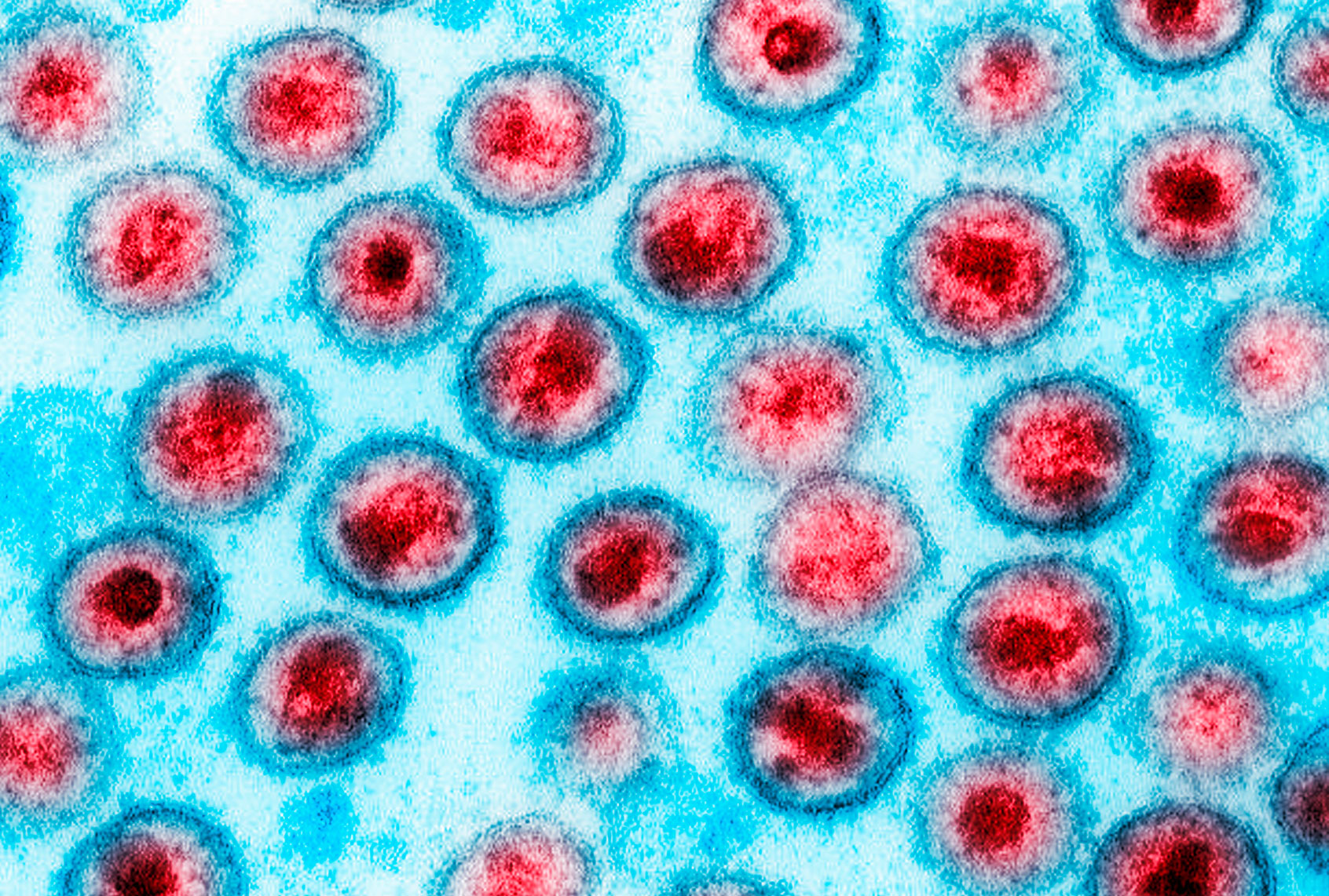Transmission electron micrograph of AIDS, HIV-1 (Getty Images)