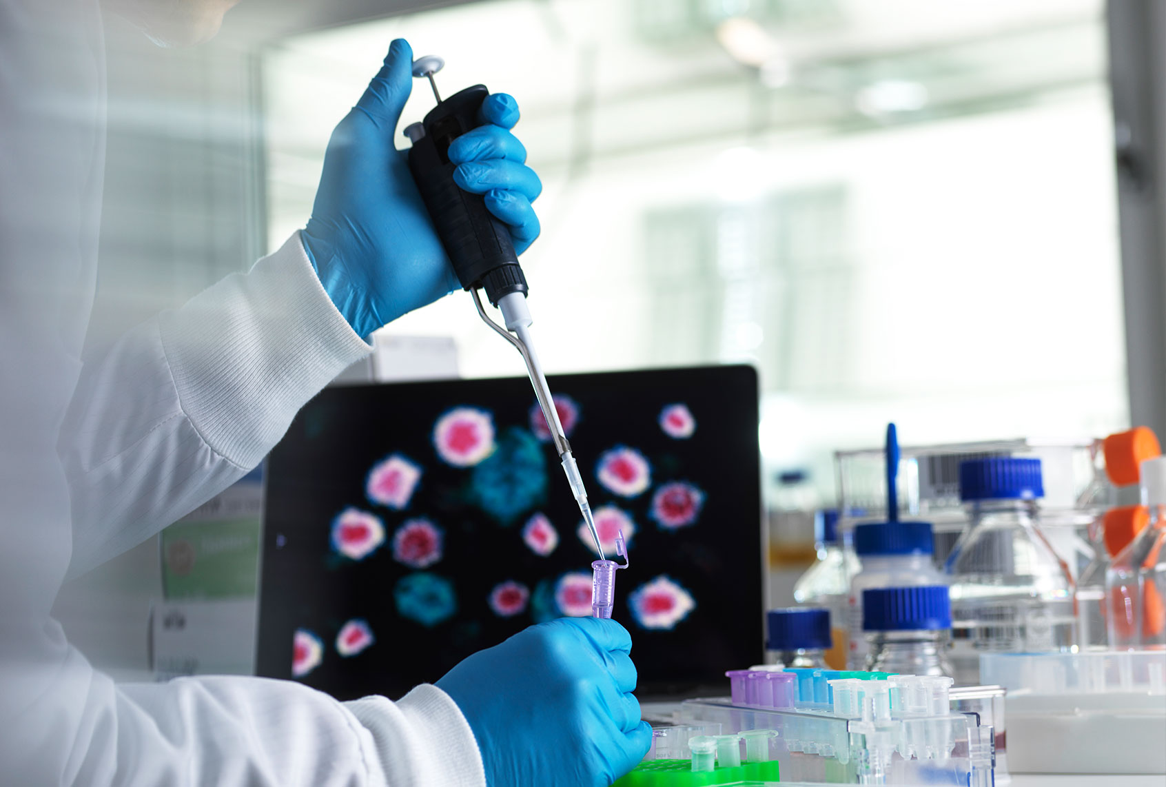 Scientist pipetting a sample of a new drug formula into a vial during a clinical trial with the infectious disease on the computer screen. (Getty Images)