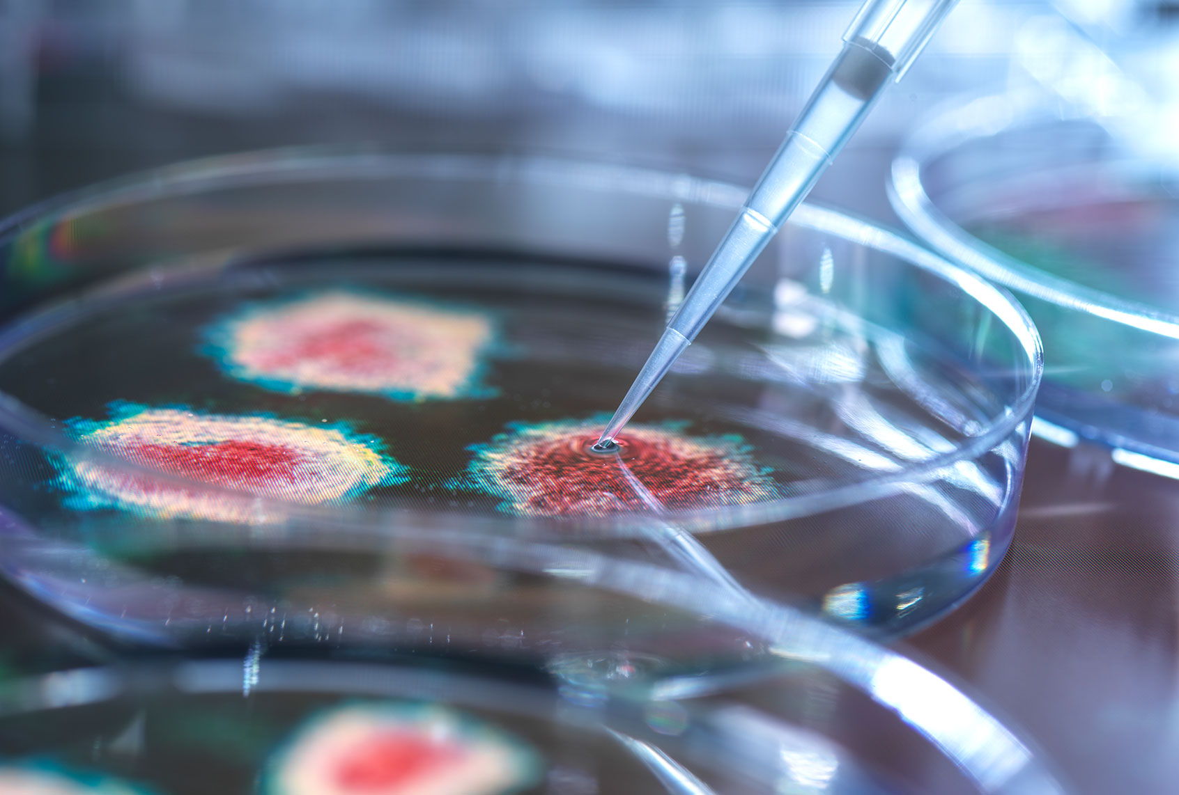Scientist pipetting a virus onto a petri dish (Getty Images)