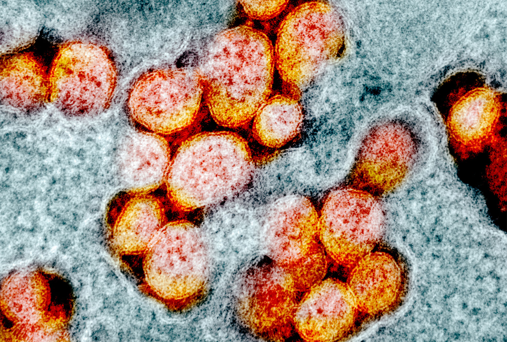 Transmission electron micrograph of coronavirus (IMAGE POINT FR/NIH/NIAID/BSIP/Universal Images Group via Getty Images)