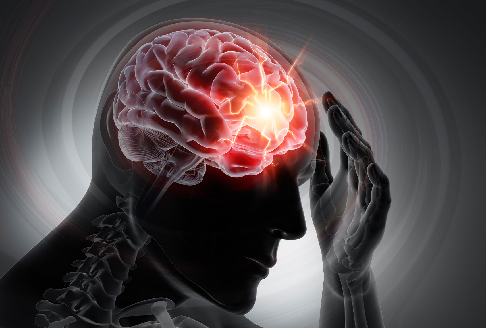 3D render of a man with strong pain in head (Getty Images/peterschreiber.media)