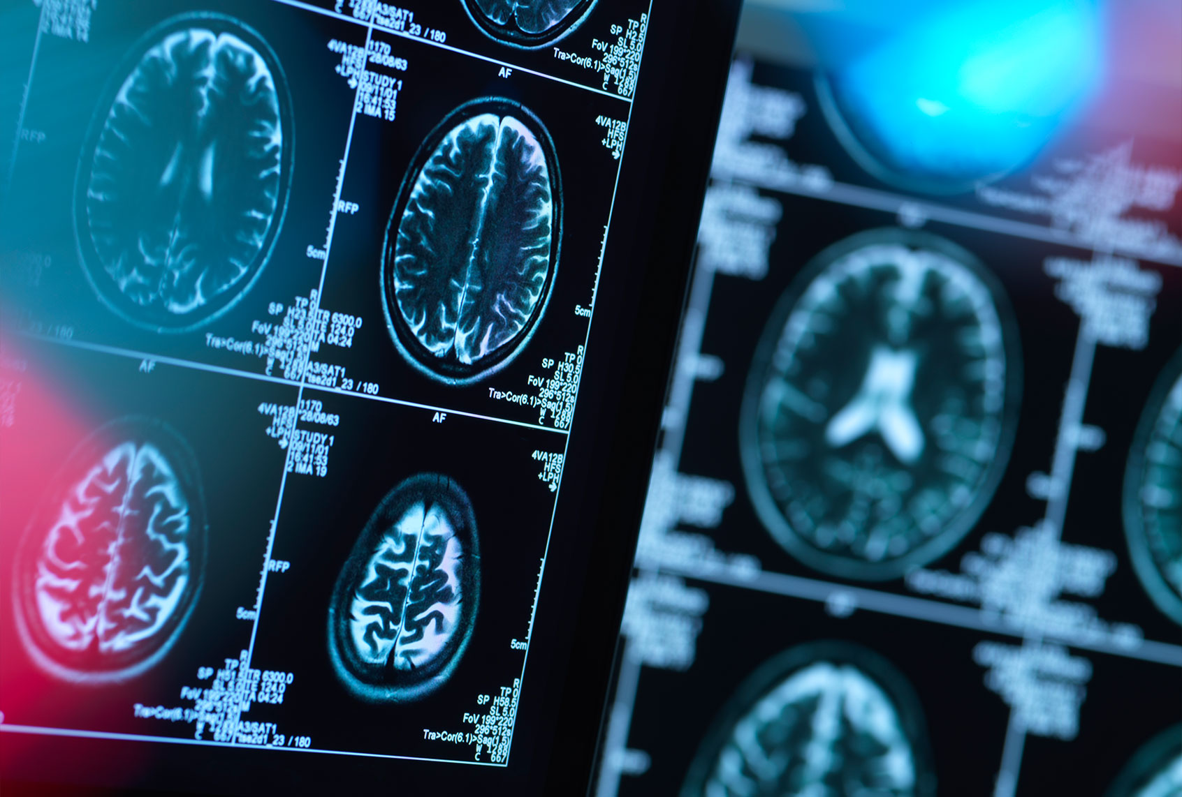 Brain scans (Getty Images/Andrew Brookes)