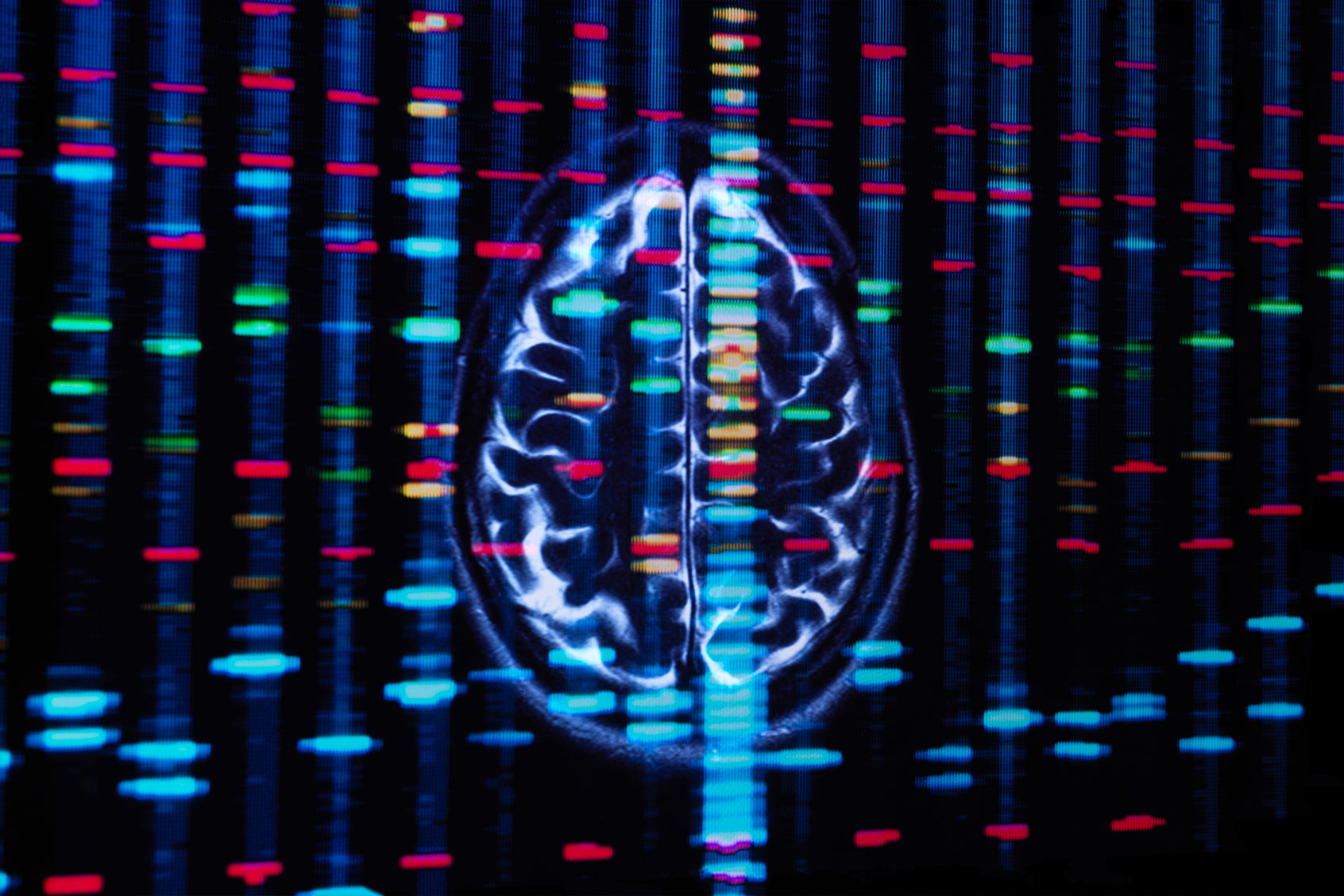 Brain Scan (Getty Images/TEK IMAGE/SCIENCE PHOTO LIBRARY)