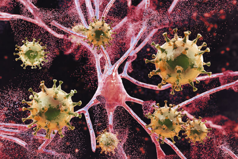 Conceptual illustration of inflammation of the brain caused by a virus (Getty Images/KATERYNA KON/SCIENCE PHOTO LIBRARY)