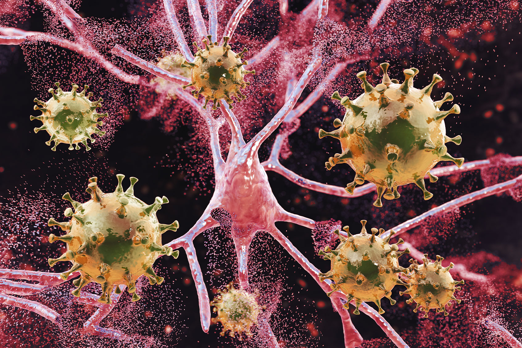 Conceptual illustration of inflammation of the brain caused by a virus (Getty Images/KATERYNA KON/SCIENCE PHOTO LIBRARY)