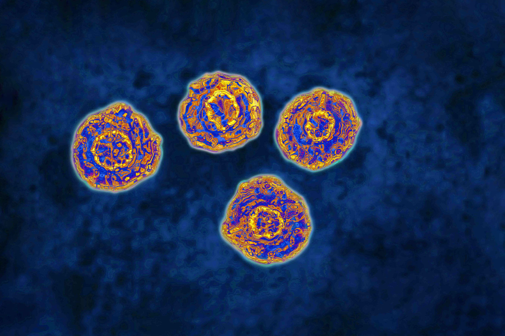 Hepatitis C virus (Getty Images/CAVALLINI JAMES/BSIP/Universal Images Group)