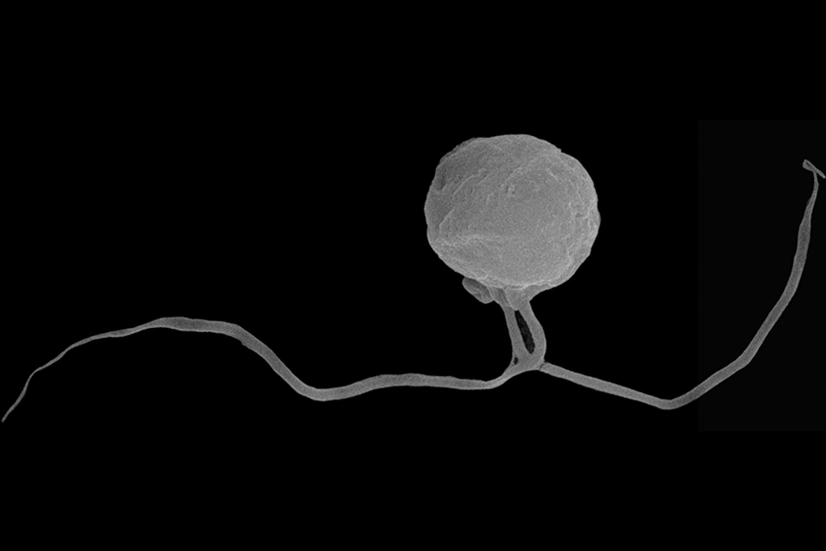 A provoran, visualized by scanning electron microscopy (Tikhonenkov, Mikhailov, Gawryluk, Belyaev, Mathur, Karpov, Zagumyonnyi, Borodina, Prokina, Mylnikov, Aleoshin, and Keeling, Nature)