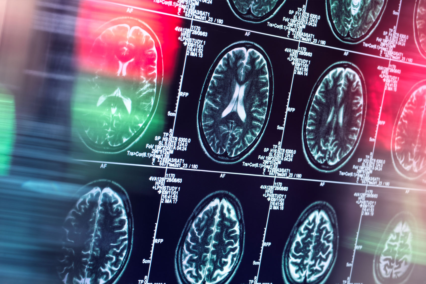 Human brain scan in neurology clinic (Getty Images/Westend61)