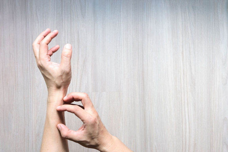 Person scratching their arm and wrist (Getty Images/Ake Ngiamsanguan)