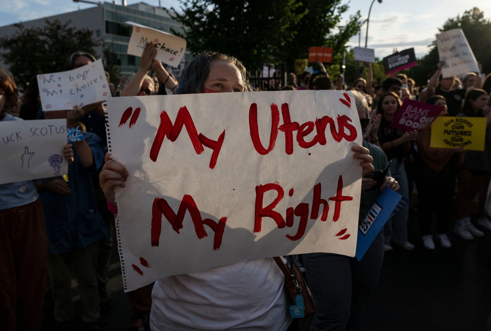 Pro-choice supporter holds a sign reading "My Uterus My Right" as activists protest outside the Planned Parenthood Reproductive Health Services Center after the overturning of Roe Vs. Wade by the US Supreme Court, in St. Louis, Missouri on June 24, 2022. (ANGELA WEISS/AFP via Getty Images)